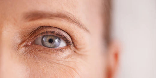 Fine Lines Around The Eyes: Causes and Treatments