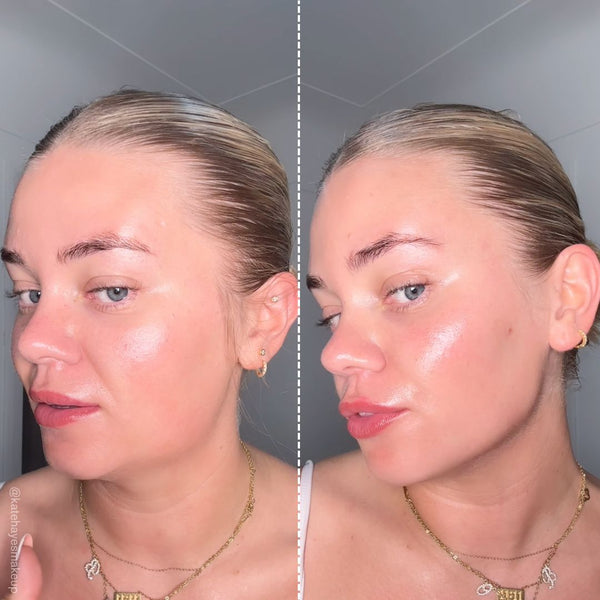 マイクロカレント美顔器 | ZIIP HALO – ZIIP JP