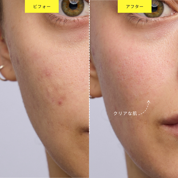 Yahoo!オークション - 開健社 ジップヒーラー スタンド付き 波動